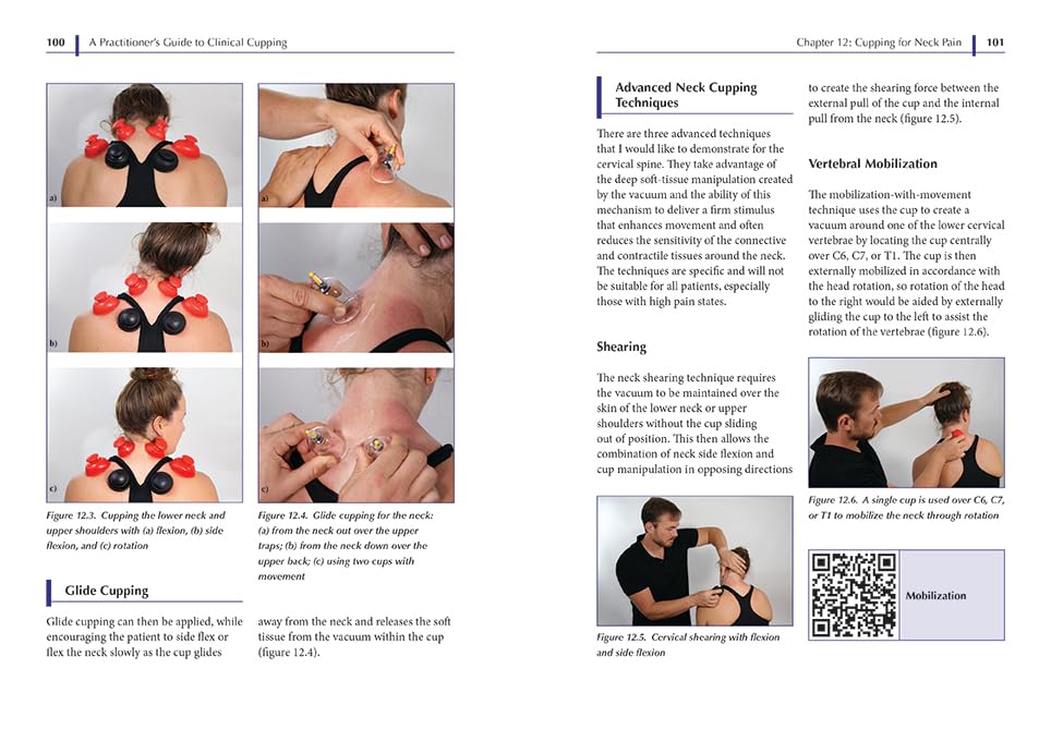 A Practitioner's Guide to Clinical Cupping: Effective Techniques for Pain Management and Injury
