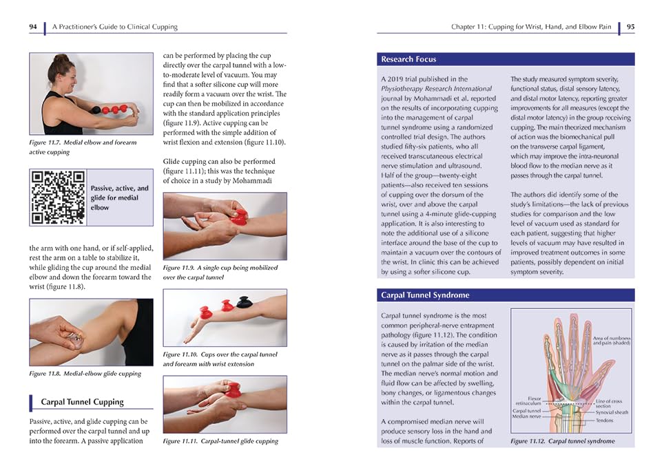 A Practitioner's Guide to Clinical Cupping: Effective Techniques for Pain Management and Injury
