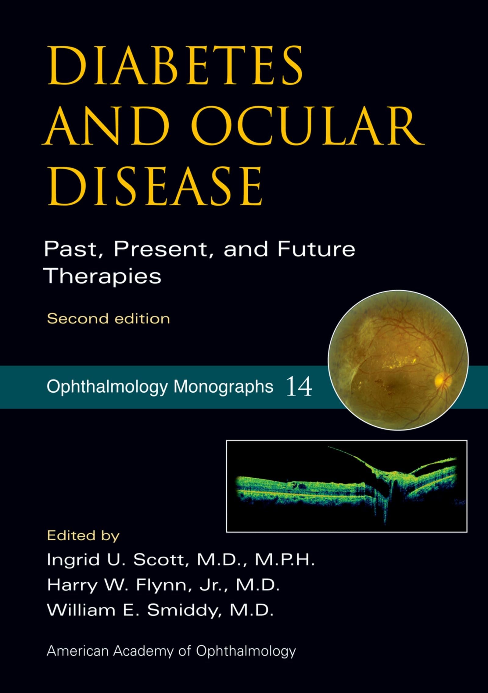 Diabetes and Ocular Disease: Past, Present, and Future Therapies (American Academy of Ophthalmology Monograph Series)
