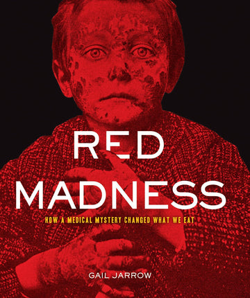 Red Madness: How a Medical Mystery Changed What We Eat (Deadly Diseases)